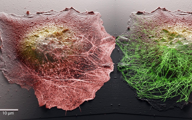 Новая комбинация микроскопических методов позволяет ученым получать изображения клеток внутри и снаружи в высоком разрешении и 3D.